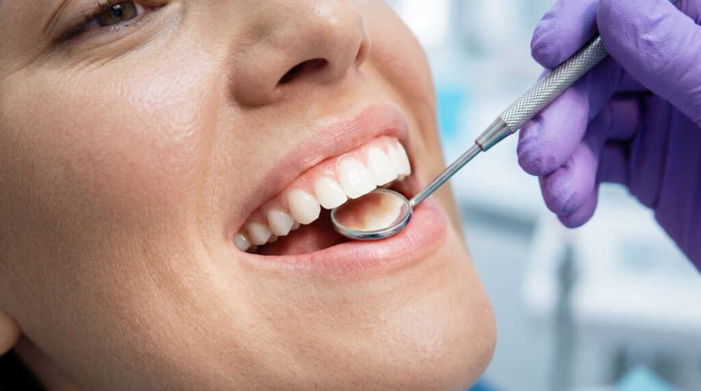 A dentist is inspecting the patient's teeth and gums